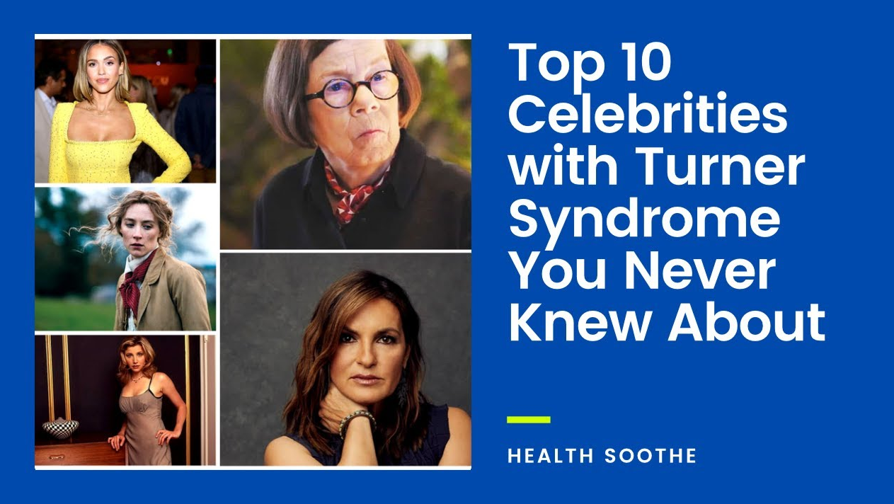 Celebrities with Turner syndrome