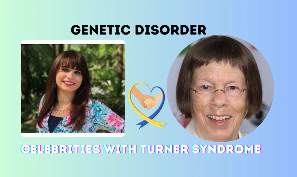 Turner Syndrome Celebrities: Courage, Talent, and Success