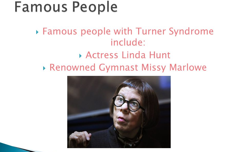 Famous Turner Syndrome Celebrities